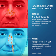 Naväge Starter Bundle: Nose Cleaner and 30 SaltPod Capsules